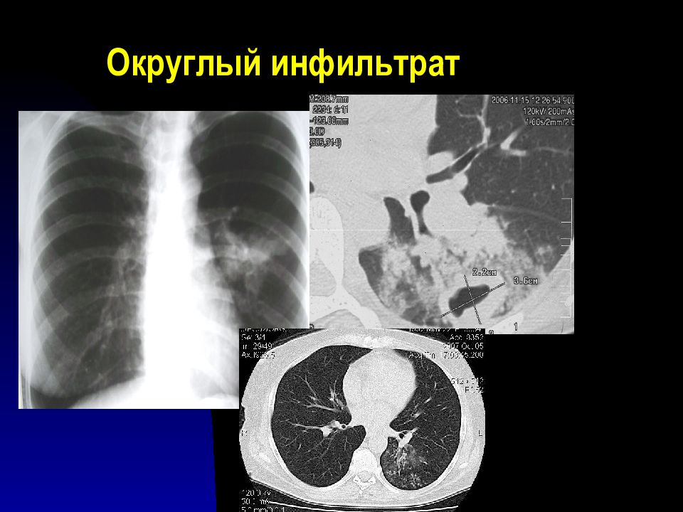 Лучевая диагностика органов дыхания презентация