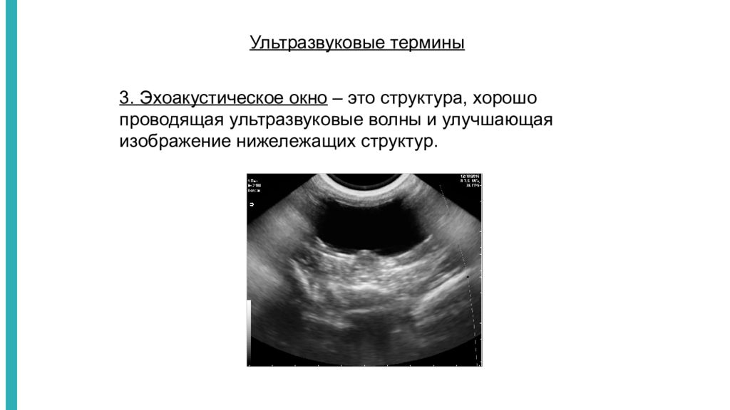 Структура узи. Термины УЗИ. Физические принципы УЗИ. УЗИ. УЗИ физические основы метода.