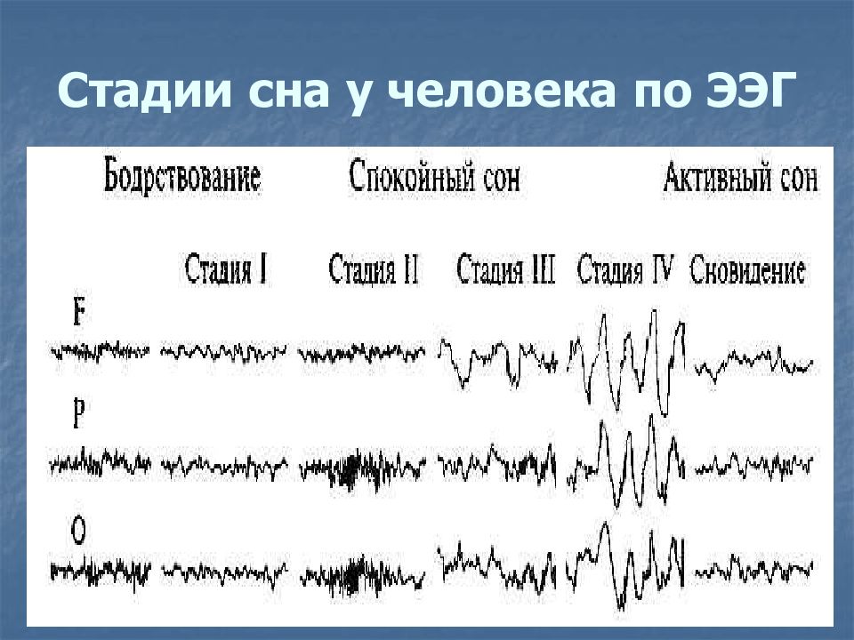 Стадии сна картинки