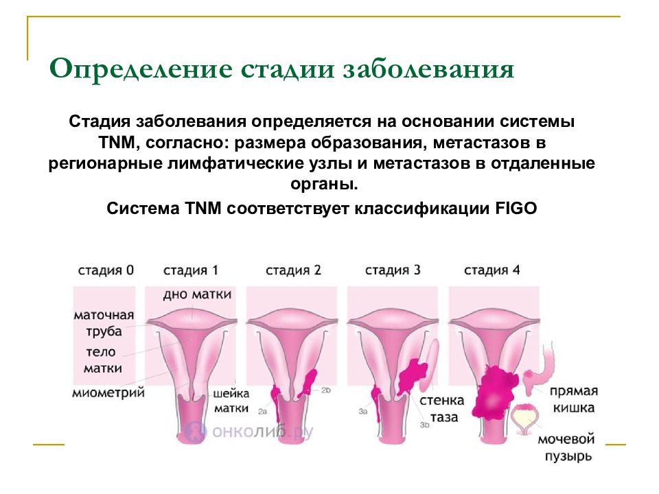 Профилактика рака тела матки презентация