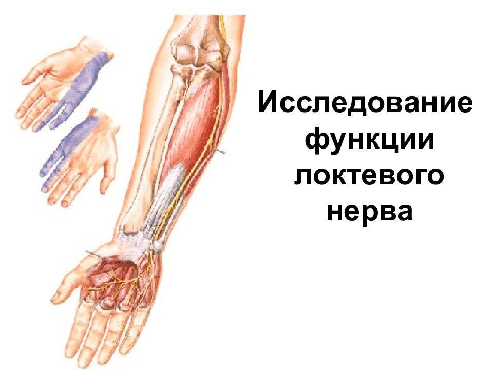 Нейропатия срамного нерва. Когтистая лапа при поражении локтевого нерва. Исследование локтевого нерва. Двигательные точки локтевого нерва.