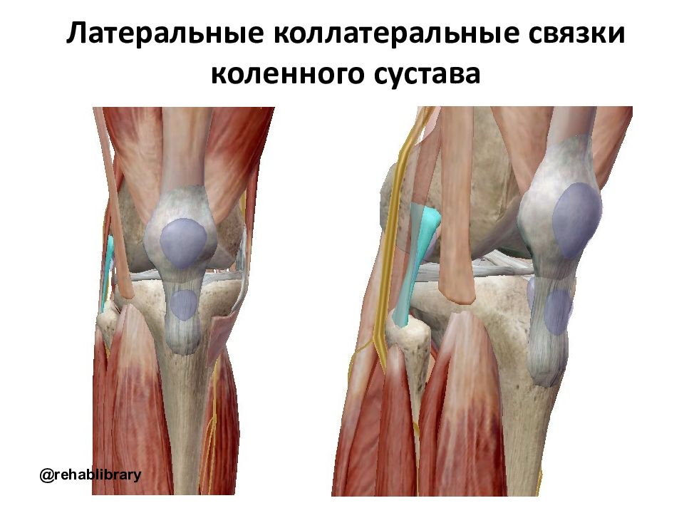 Латеральный разрыв. Коллатеральная связка коленного сустава. Связки и сухожилия коленного сустава. Большеберцовая коллатеральная связка. Латеральное сухожилие коленного сустава.