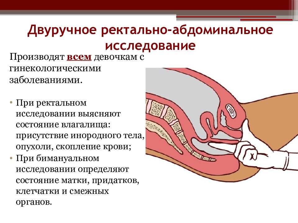 Презентация гинекологические заболевания