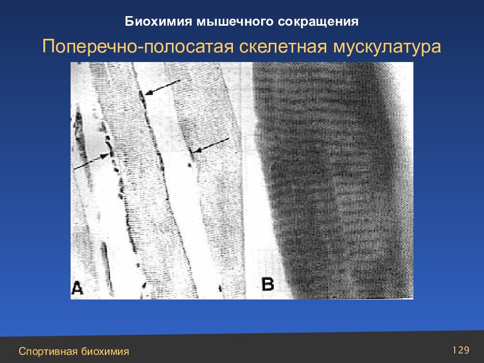 Сокращение поперечно полосатой мускулатуры. Высокая Скелетная мускулатура это. Отсутствие сокращение поперечнополосатой мускулатуры одним словом. Индекс скелетной мускулатуры по Баумгартену.