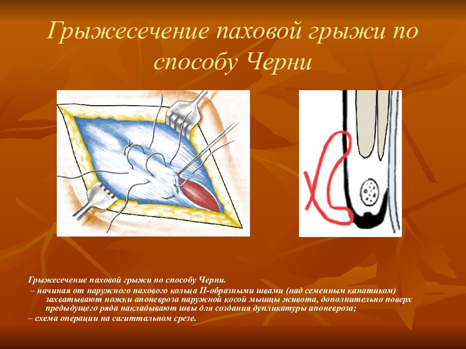 Презентация топографическая анатомия