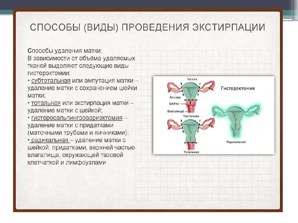 Ампутация матки фото