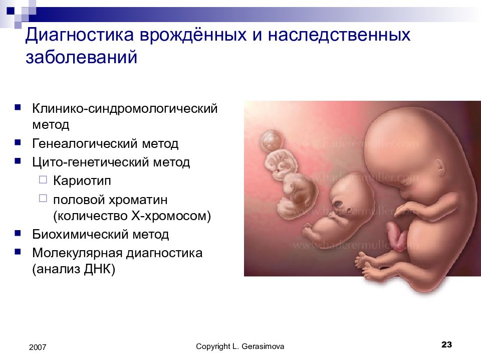 Наследственность и патология презентация