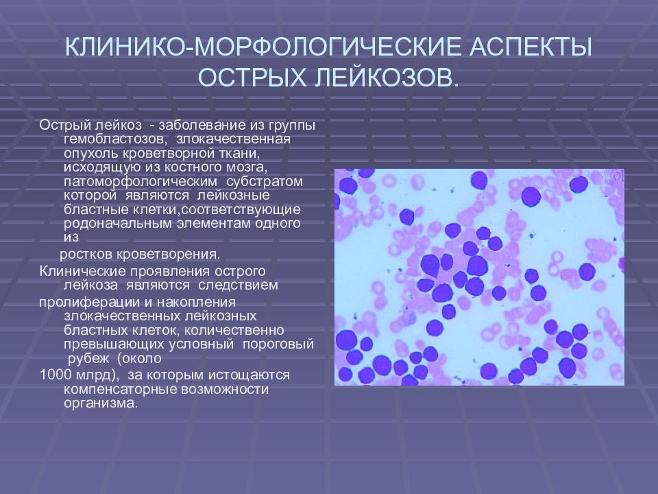 Характеристики лейкоза. Классификация острых лейкозов. Морфологическая характеристика лейкозов. Острые лейкозы клинико морфологическая характеристика. Причины анемии при лейкозах.