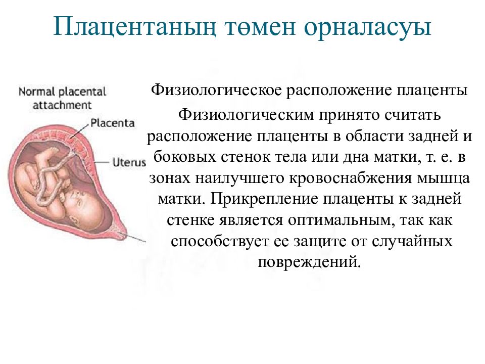 Плацента по задней стенке. Плацента расположена в дне матки. Расположение плаценты в дне что это. Прикрепление плаценты к дну матки. Плацента расположена у дна матки.