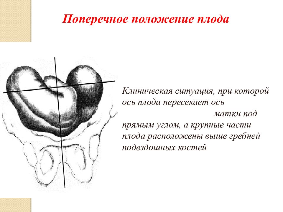 Презентация головка плода