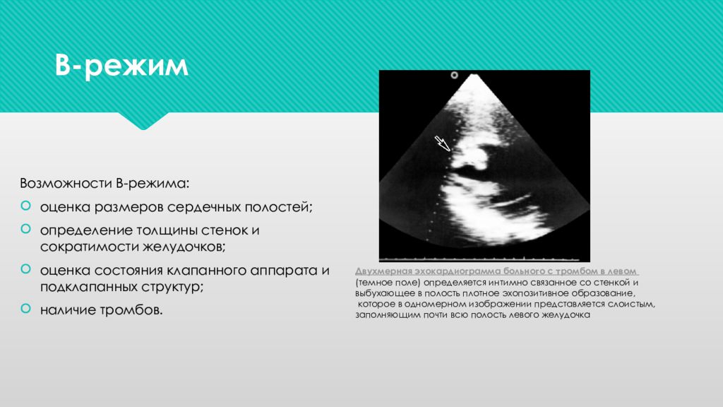 Способы представления изображения в частотной области