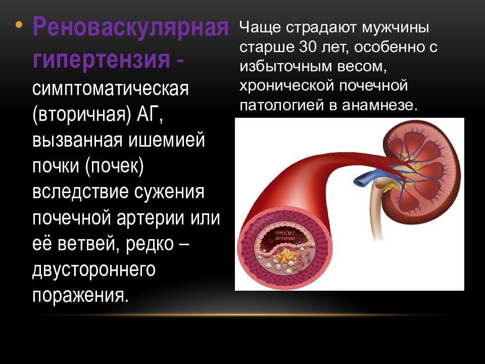 Вазоренальная гипертензия презентация