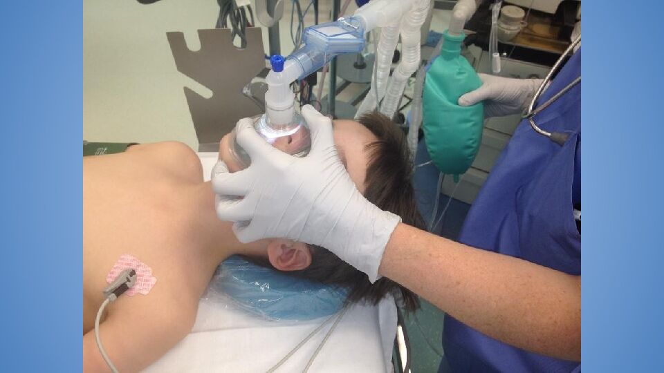 Трудные дыхательные пути в анестезиологической практике. Difficult Airway