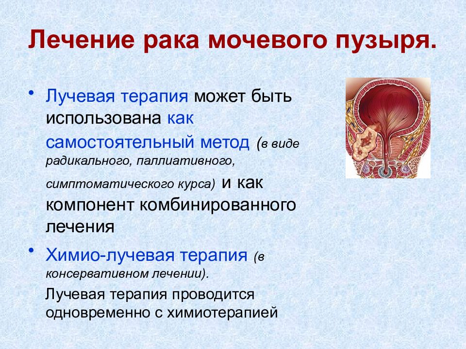 Рак мочевого. Опухоль мочевого пузыря. Опухоли мочевого пузыря презентация. Опухоль мочевого пузыря лекарство. Опухоли мочевого пузыря клиника.