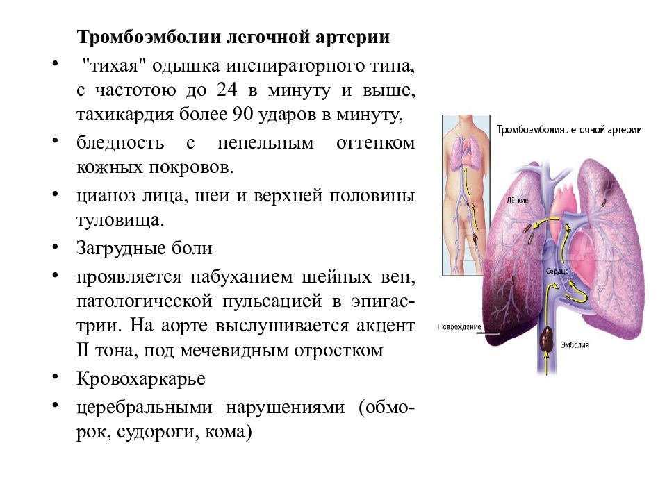 Тромбоэмболия легочной артерии презентация