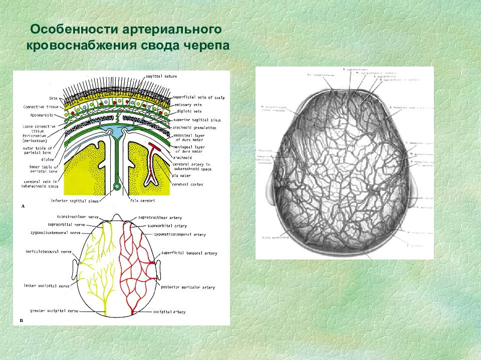 Сосудистый рисунок костей свода черепа усилен