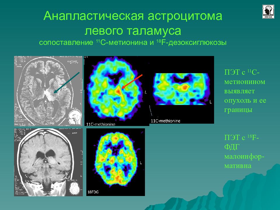 Лучевая диагностика нервной системы презентация