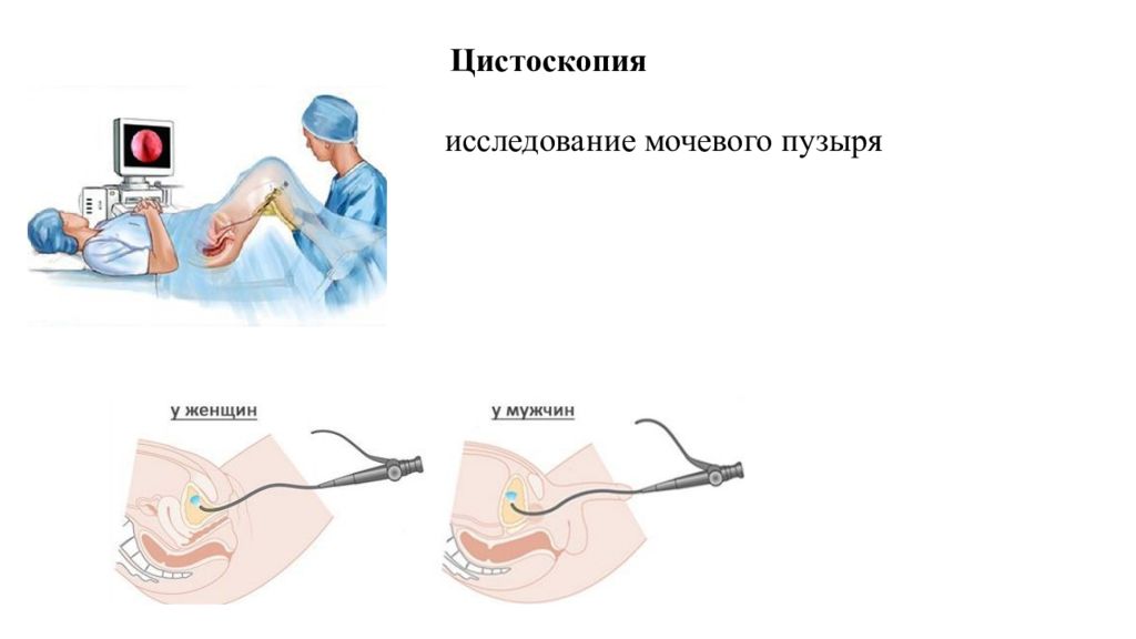 Подготовка женщин к исследованию. Инструментальные методы исследования мочевого пузыря. Диагностическая цистоскопия. Цистоскопия мочевого пузыря.