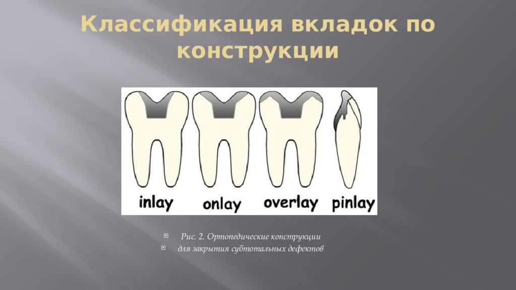 Вкладки ортопедическая стоматология презентация