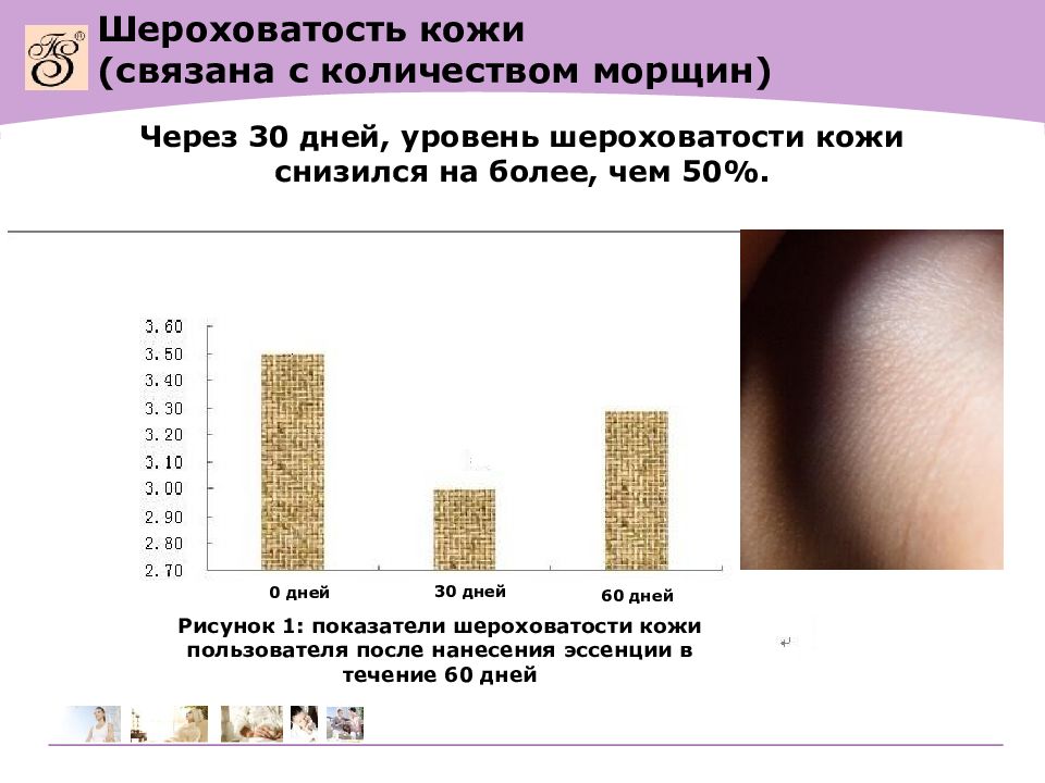 Количество кожи. Шероховатость кожи шероховатость. Шероховатость на коже лица. Шероховатость на коже у ребенка. Количество содержания в коже.