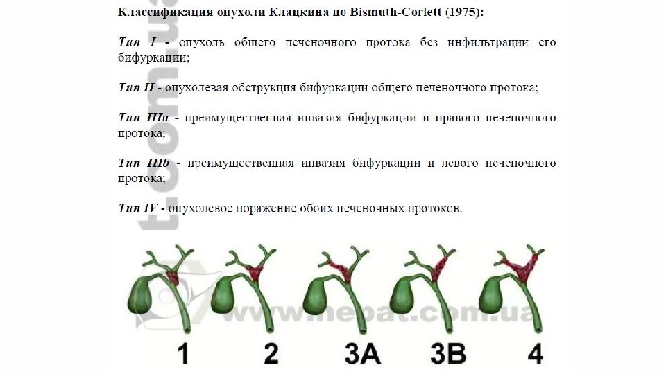 Опухоли желчного пузыря презентация