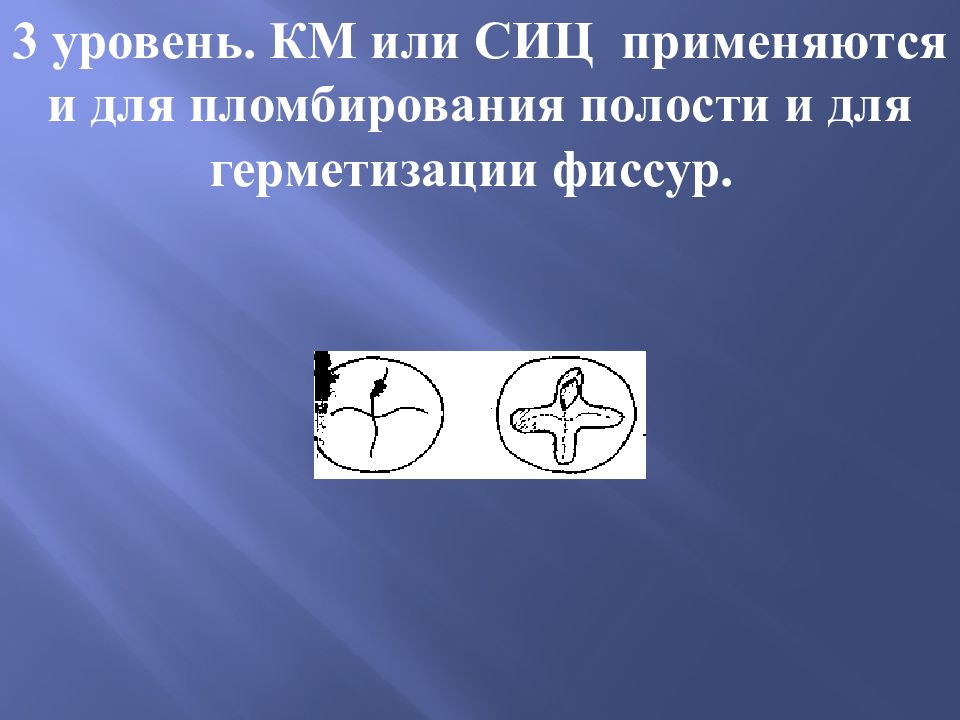 Пломбирование сиц. СИЦ для герметизации фиссур. Герметизация фиссур стеклоиономерными цементами. Схема ориентировочных действий при пломбировании СИЦ. Минусы СИЦ.