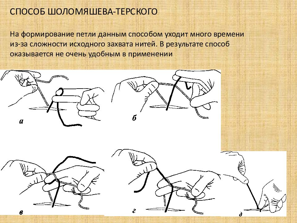 Дай способ. Хирургический узел по Джанелидзе. Хирургический узел Оперативная хирургия. Хирургические узлы техника. Способы формирования хирургических узлов.