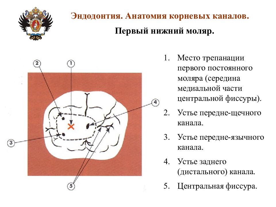 Анатомия каналов. Нижний моляр анатомия корневых каналов. Анатомия корневых каналов нижних моляров нижней. Корневые каналы верхнего первого моляра. Топография устьев корневых каналов Нижний моляр.