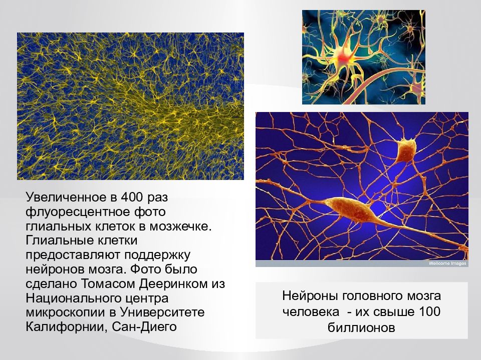 Какая ткань организма человека содержит глиальные клетки. Нейроны и глиальные клетки. Глиальные клетки нервной ткани. Нейроглия глиальные клетки. Глиальные клетки физиология.