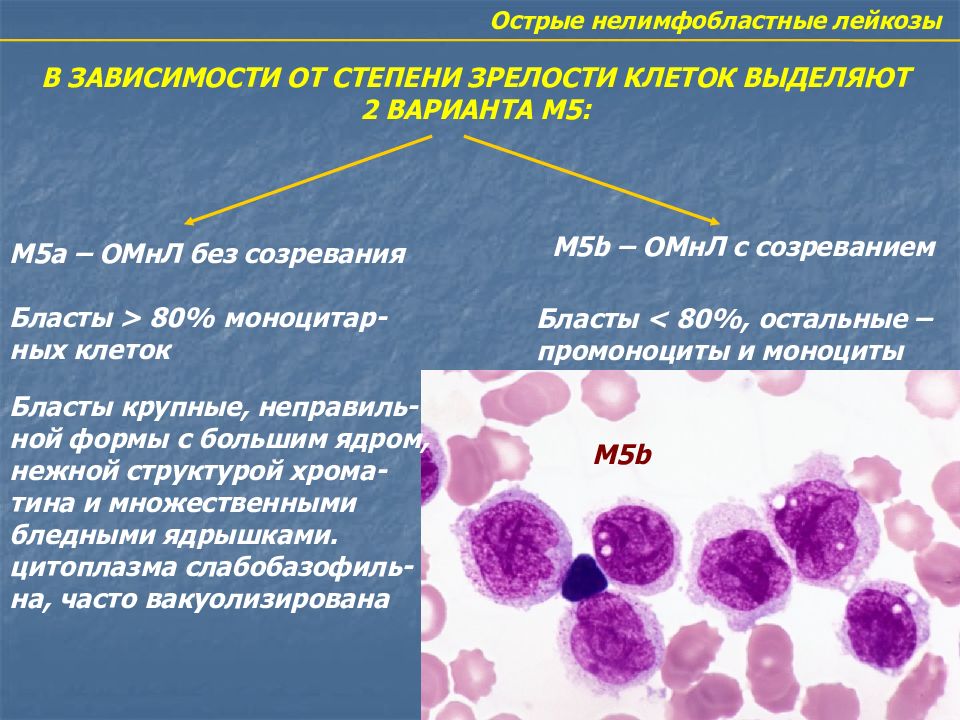 Острый лимфолейкоз презентация