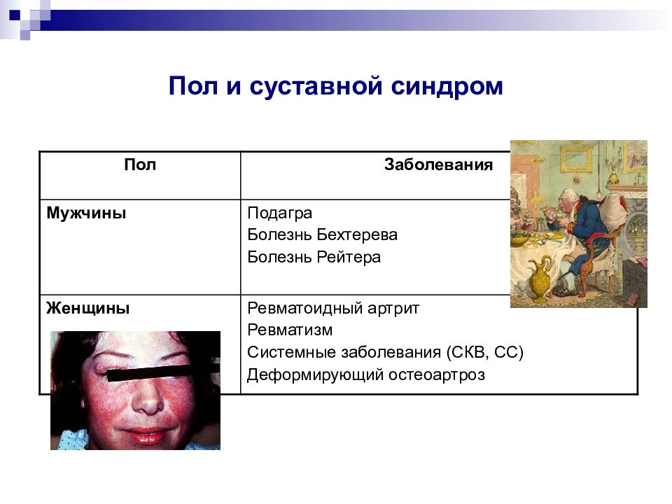 Суставной синдром презентация