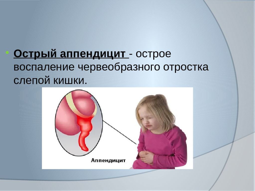 Аппендицит в 3 года. Острый аппендицит у детей. Воспаление червеобразного отростка. Как выглядит аппендикс у детей.
