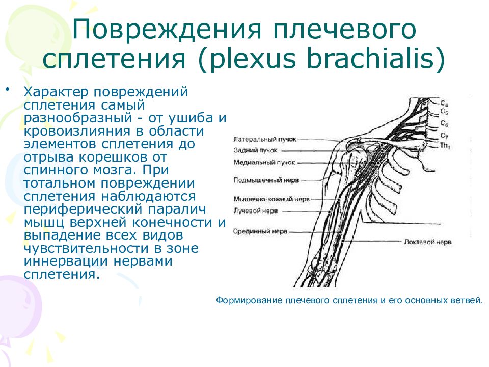 Сосудистые пучки это. Ветви плечевого сплетения анатомия. Плечевое сплетение схема нервов. Короткие ветви плечевого сплетения схема. Поражение плечевого сплетения схема.