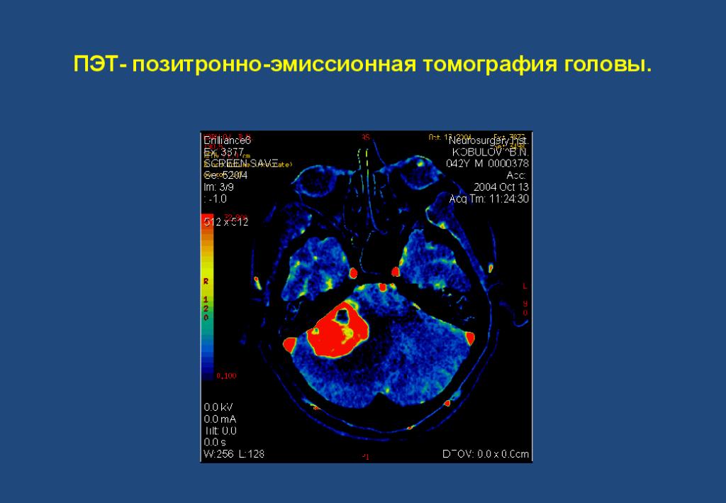 Методы позитронно эмиссионной томографии