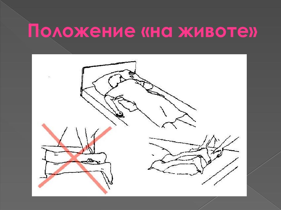 Положение на животе. Положение пациента на животе. Размещение пациента в положение на животе. Положение пациента лежа на животе. Размещение пациента лежа на животе.