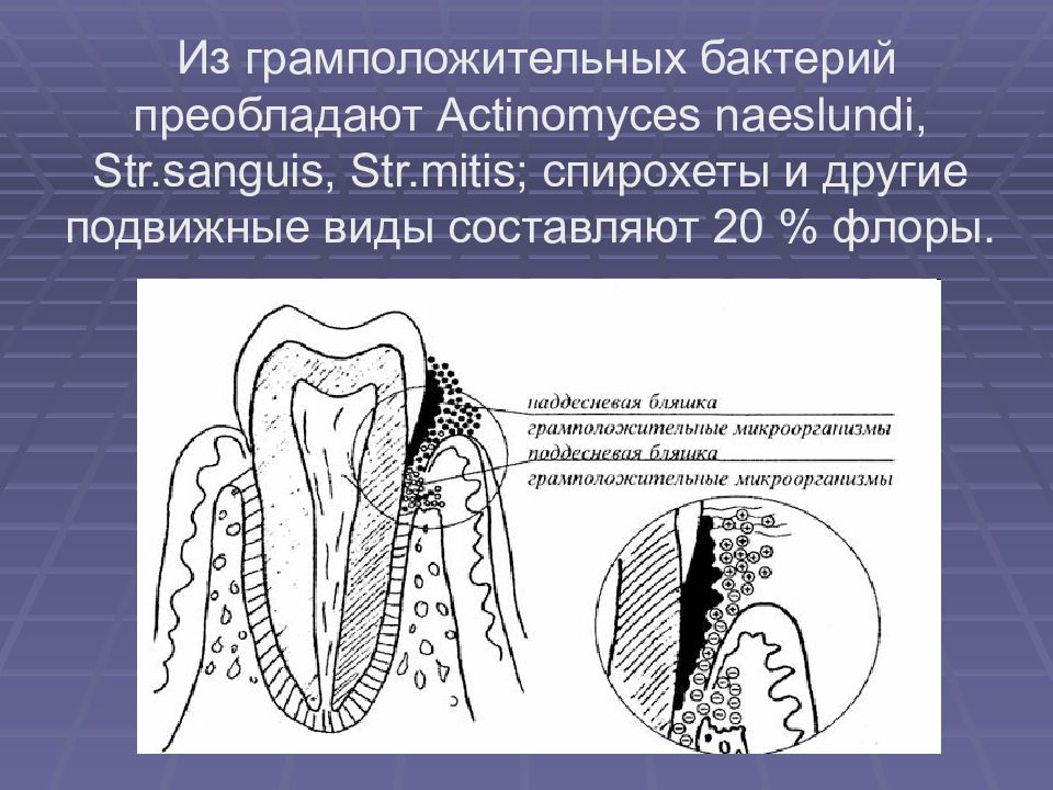 Этиология патогенез пародонта. Строение пародонта. Этиология заболеваний пародонта. Патогенез воспаления пародонта. Патогенез заболеваний пародонта схема.