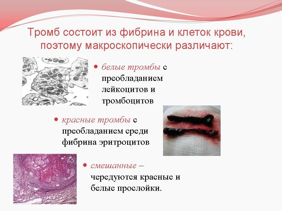 Патология кровообращения и лимфообращения презентация