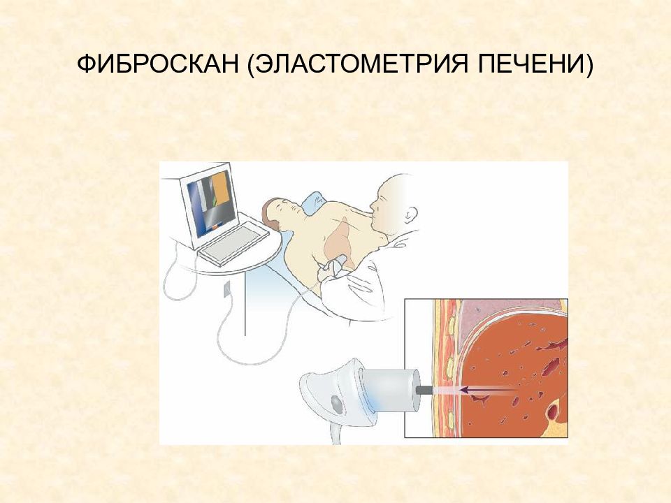 Эластометрия где сделать. Эластометрия печени показатели f4. Эластометрия печени УЗИ. Транзиентная эластография печени исследование фиброскан. Фибросканирование (эластометрия печени).