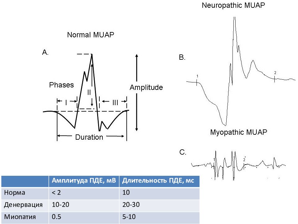 Амплитуда 20 и 20. Амплитуда ПДЕ. Амплитуда сигнала ЭМГ. Потенциал двигательной единицы. Функциональная диагностика мышц.
