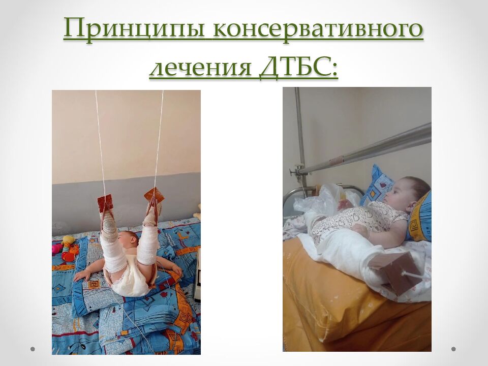 Принципы консервативного лечения ДТБС: