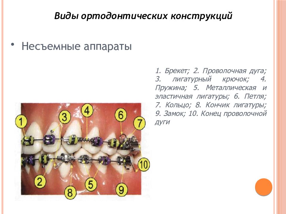 Ортодонтическое лечение детей презентация