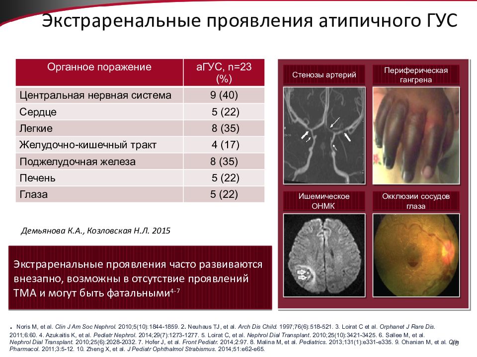 Гемолитико уремический синдром у детей презентация