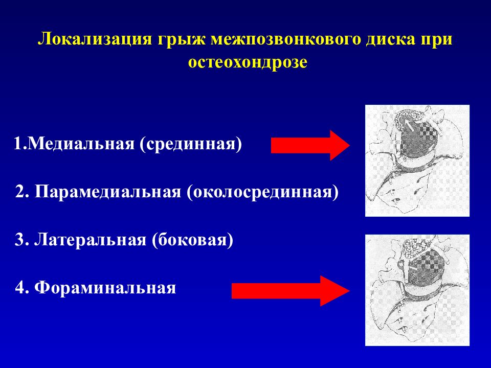 Образец оформления карты вызова грудной остеохондроз