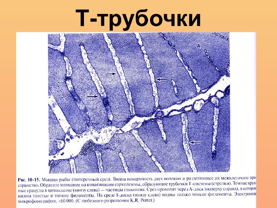 Т система. Т трубочки мышечного волокна. Поперечные трубочки. Система т трубочек. Т система поперечных трубочек.