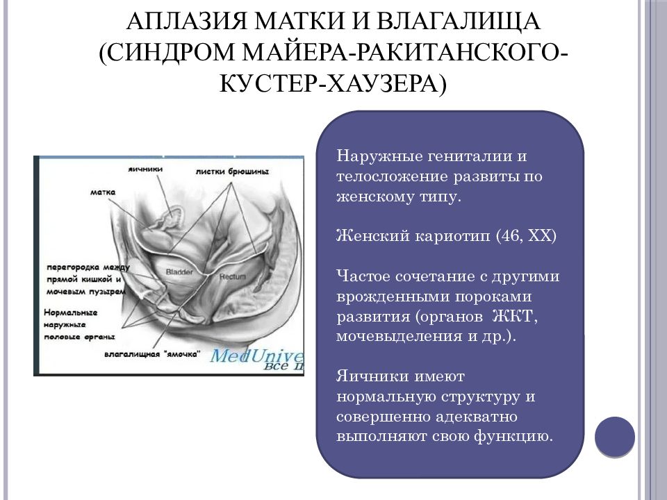 Аномалии развития мужских половых органов презентация