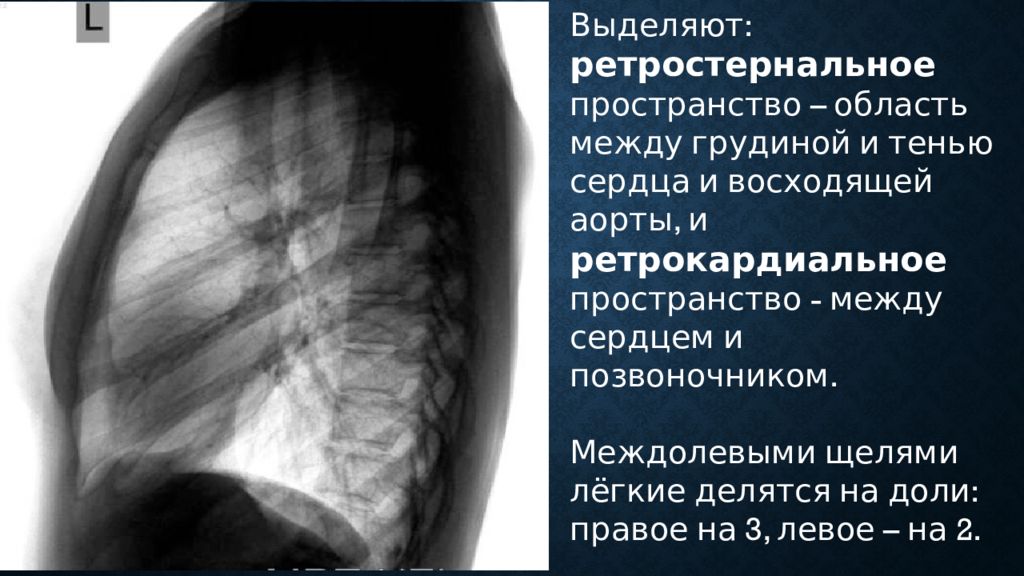 Флюорография проекции. Рентген грудной клетки в боковой проекции норма. Рентген легких боковая проекция норма. Рентгенография легких боковая проекция норма. Рентген грудины боковая проекция.