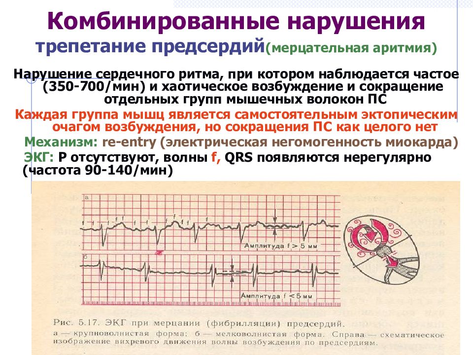 Нарушение ритма сердца карта вызова