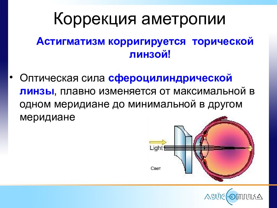 Астигматизм какой. Торические контактные линзы для астигматизма. Астигматические линзы сфера цилиндр. Принципы очковой коррекции аметропии. Астигматизм коррекция торические линзы.