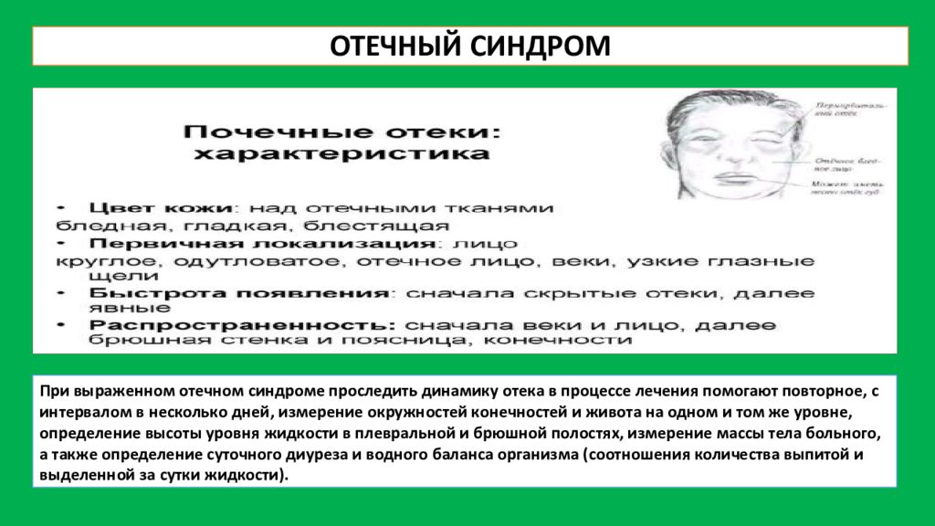 Синдром отека. Отечный синдром причины. Терапия отечного синдрома.