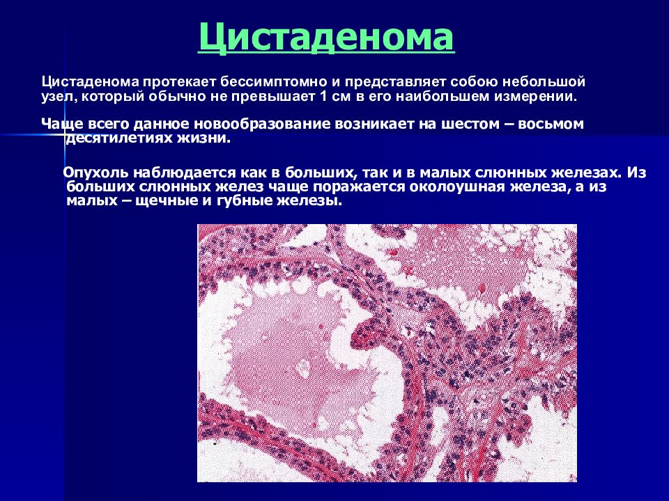 Заболевания слюнных желез у детей презентация